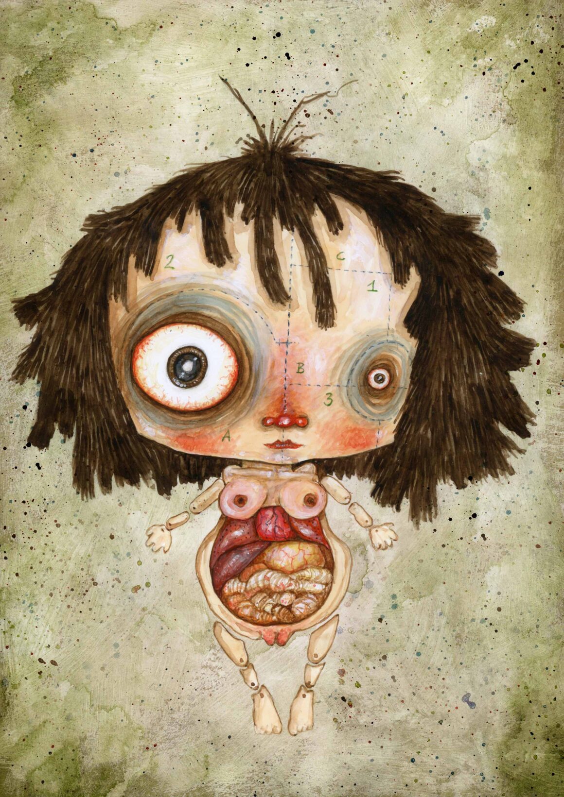 Bambola anatomica, Stefano Bessoni